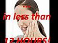 Best Toothache Cure- 12-Hour Natural Cure