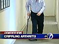 VIDEO: Arthritis that strikes mostly men