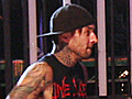 Travis Barker Leaves Burn Center