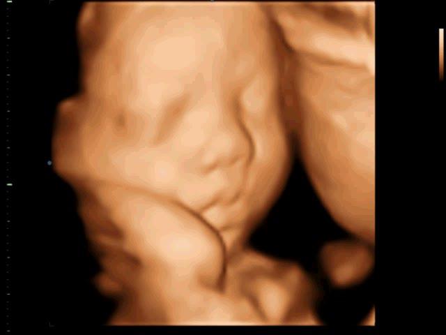 Baby Boy 29 weeks