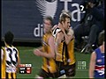 Hawthorn captain undergoes surgery