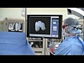 Seattle Hosp. Surgery Webcast Today