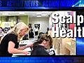 VIDEO: Health clues from your scalp