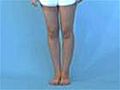 Knee Exam: Inspection: Standing  (2 Of 27)