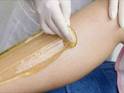 Pros and Cons of Sugaring