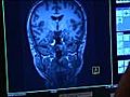 New technology may help detect Alzheimer’s