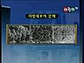 레이저가슴축소술로 거대유방 축소 시술 원리-비에스클리닉 이선영 원장님