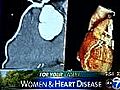 For Your Family: Women and Heart Health