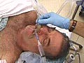 Intubation of the Esophagus