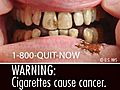 FDA Issues New Graphic Cigarette Labels