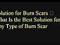 Cures for Burn Scars – What Is the Most excellent Solution for Any Type of Burn Scar