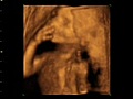 Window to the womb 4D baby scan 20 to 23 week baby