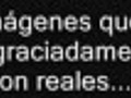 Hambre Impactante y muy triste